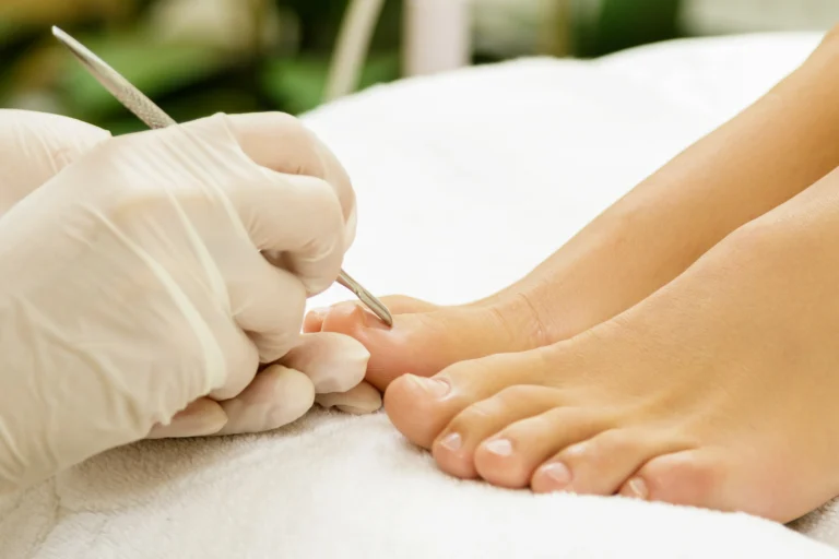 pedicura